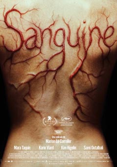 Sanguine